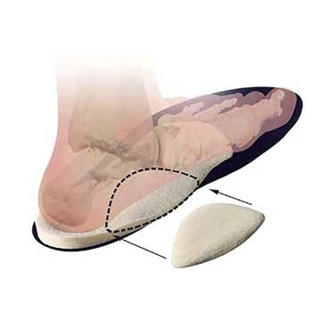 Load image into Gallery viewer, Hapad Scaphoid Pads