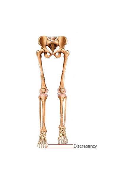 Load image into Gallery viewer, Hapad Heel Pads