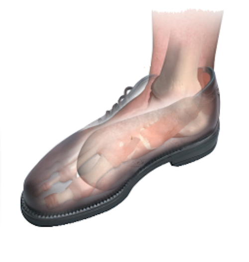 Load image into Gallery viewer, Hapad Comf-Orthotic 3/4 Length Insoles