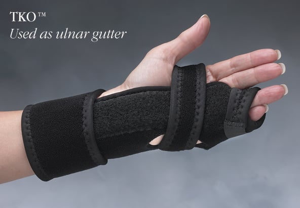 Load image into Gallery viewer, Hely & Weber TKO™ Knuckle Orthosis