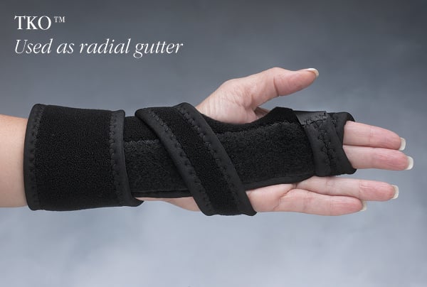 Load image into Gallery viewer, Hely & Weber TKO™ Knuckle Orthosis