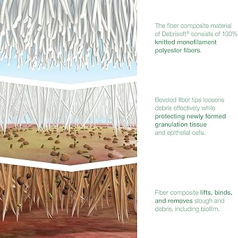 Lohmann & Rauscher Debrisoft® Lolly, Box of 5