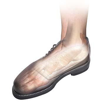 Load image into Gallery viewer, Hapad 3/4 Length Heel Wedges