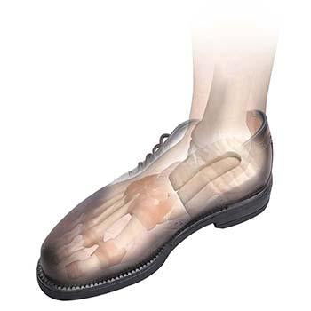 Hapad Horseshoe Heel Cushions