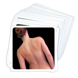OPTP NOI Recognise™ Back Flash Cards