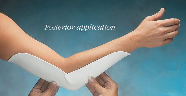 Load image into Gallery viewer, North Coast Medical Elbow Precut Splint