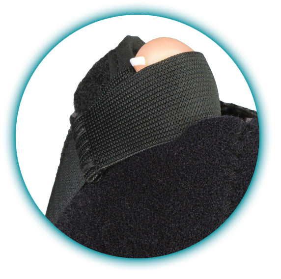 Load image into Gallery viewer, MedSpec Phantom™ Dorsal Night Splint