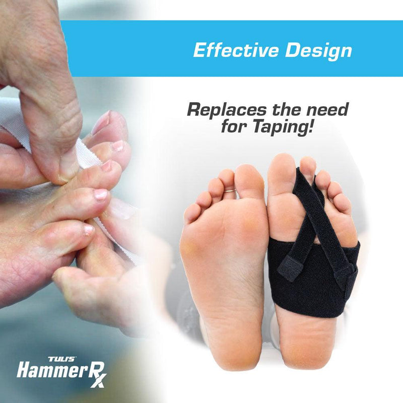 Load image into Gallery viewer, Tuli&#39;s Hammer RX Toe Straightener
