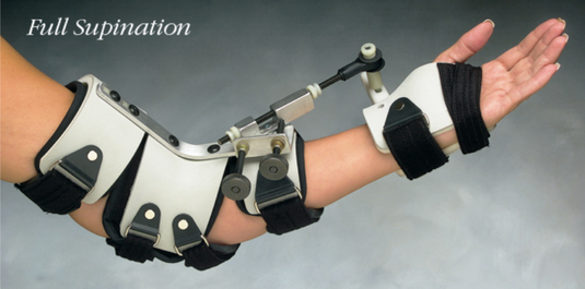 Progress™-Plus Pronation/Supination Turnbuckle Orthosis