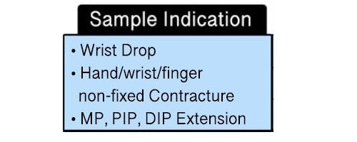 Load image into Gallery viewer, ComfySplints™ Spring Loaded Goniometer Hand Orthosis, Adult
