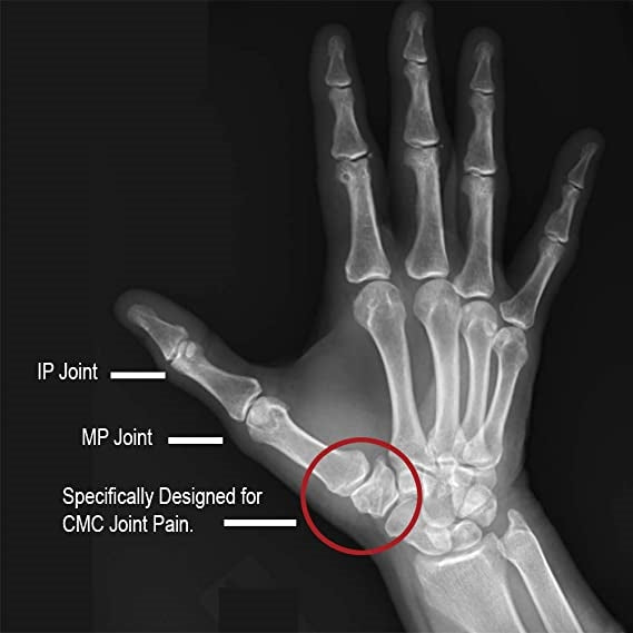 Load image into Gallery viewer, Comfort Cool® Thumb CMC Restriction Splint
