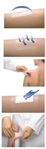 Load image into Gallery viewer, BSN Medical Leukomed T Plus Post-Op Dressing
