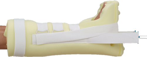 DeRoyal Specialty Buck’s Traction Boot