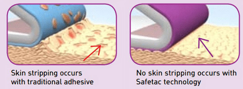 Load image into Gallery viewer, Mölnlycke Mepilex Soft Silicone Absorbent Foam Dressing
