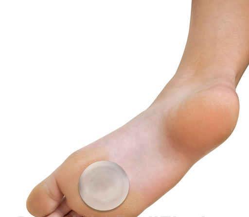 Load image into Gallery viewer, Pedifix Pedi-GEL Reusable Callus Cushions
