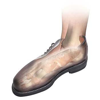 Load image into Gallery viewer, Hapad Comf-Orthotic Full Length Insoles

