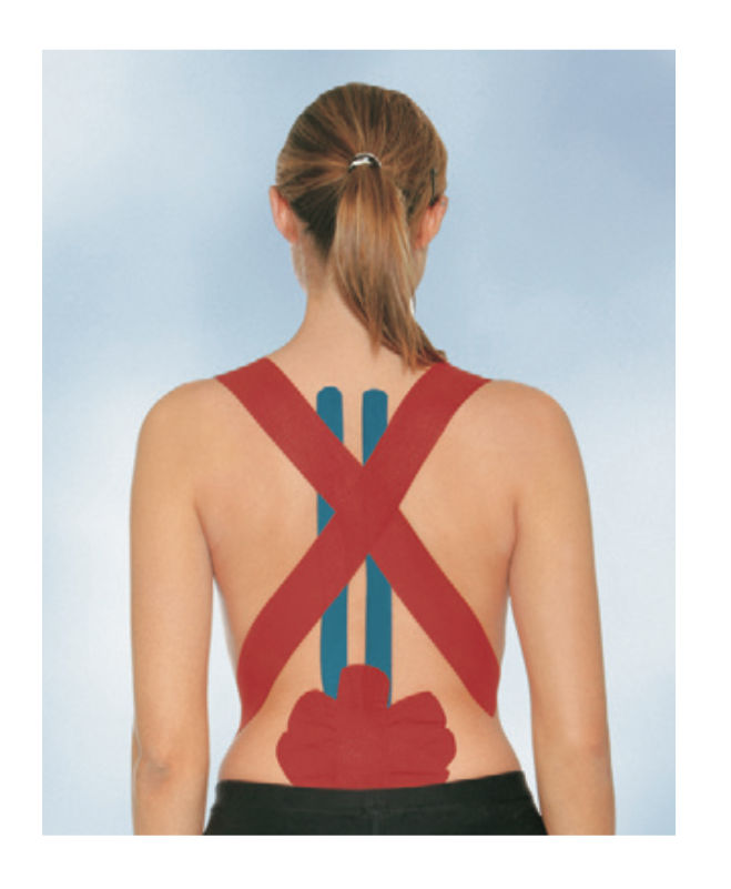 Load image into Gallery viewer, BSN Medical Leukotape K - Kinesiology Therapeutic Adhesive Tape
