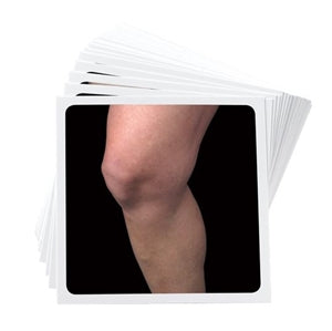 OPTP NOI Recognise™ Knee Flash Cards